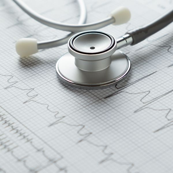 Electrocardiograma