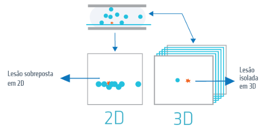 diferença entre mamografia 2D e 3D